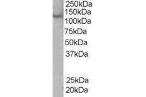 Western Blotting (WB) image for Zinc Finger, FYVE Domain Containing 20 (ZFYVE20) peptide (ABIN369019) (Zinc Finger, FYVE Domain Containing 20 (ZFYVE20) Peptid)