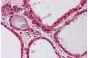 anti-Protein Phosphatase 2, Regulatory Subunit A, alpha (PPP2R1A) (AA 107-156) antibody