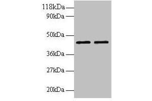 Western blot All lanes: B4GALT3 antibody at 2 μg/mL Lane 1: EC109 whole cell lysate Lane 2: 293T whole cell lysate Secondary Goat polyclonal to rabbit IgG at 1/15000 dilution Predicted band size: 44, 16 kDa Observed band size: 44 kDa (B4GALT3 Antikörper  (AA 34-393))