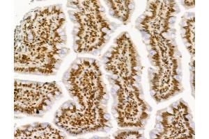 ABIN6261968 and ABIN6277736 at 1/100 staining Rat colon tissue by IHC-P. (GLI1 Antikörper  (C-Term))