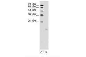 Image no. 1 for anti-PTPRF Interacting Protein, Binding Protein 1 (Liprin beta 1) (PPFIBP1) (AA 41-90) antibody (ABIN203505) (PPFIBP1 Antikörper  (AA 41-90))