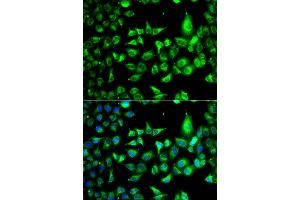 Immunofluorescence analysis of A549 cells using ACCS antibody (ABIN6293455). (PHACS Antikörper)