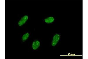 Immunofluorescence of purified MaxPab antibody to VENTX on HepG2 cell. (VENTX Antikörper  (AA 1-258))