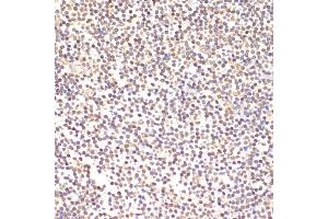 Immunohistochemistry of paraffin-embedded human tonsil using TI antibody (2517) at dilution of 1:100 (40x lens). (TIA1 Antikörper  (AA 1-193))