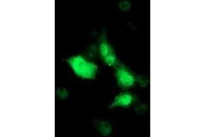 Anti-SOCS3 mouse monoclonal antibody (ABIN2454686) immunofluorescent staining of COS7 cells transiently transfected by pCMV6-ENTRY SOCS3 (RC209305).