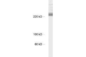 antibody dilution: 1 : 1000, sample: rat hippocampus lysate (CACNA1B Antikörper  (alpha-1E subunit))