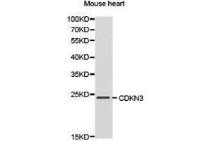 Western Blotting (WB) image for anti-Cyclin-Dependent Kinase Inhibitor 3 (CDKN3) antibody (ABIN1871769) (CDKN3 Antikörper)