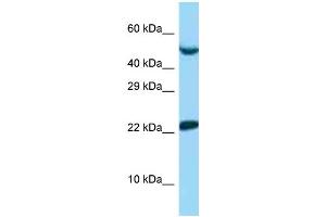 WB Suggested Anti-UBE2E1 Antibody   Titration: 1. (UBE2E1 Antikörper  (N-Term))