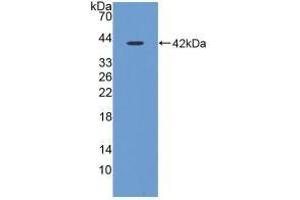 Detection of Recombinant CST3, Porcine using Polyclonal Antibody to Cystatin C (Cys-C) (CST3 Antikörper  (AA 42-127))
