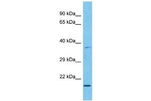 Host:  Rabbit  Target Name:  MXD3  Sample Type:  Esophagus Tumor lysates  Antibody Dilution:  1. (MXD3 Antikörper  (C-Term))