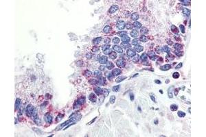 Immunohistochemistry (Paraffin-embedded Sections) (IHC (p)) image for anti-Tumor Necrosis Factor (Ligand) Superfamily, Member 13 (TNFSF13) (Extracellular Domain) antibody (ABIN499325)