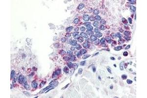 Immunohistochemistry of APRIL in human prostate tissue with APRIL antibody at 10 μg/ml. (TNFSF13 Antikörper  (Extracellular Domain))