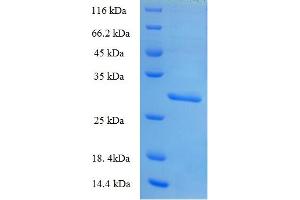 SDS-PAGE (SDS) image for Nucleoredoxin-Like 2 (NXNL2) (AA 1-135), (full length) protein (His-SUMO Tag) (ABIN5711407)