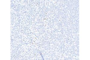 Immunohistochemistry (IHC) image for anti-Forkhead Box P3 (FOXP3) (AA 275-325) antibody (ABIN7455209) (Rekombinanter FOXP3 Antikörper  (AA 275-325))