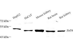 Western blot analysis of Znt6 (ABIN7075673),at dilution of 1: 1000 (SLC30A6 Antikörper)