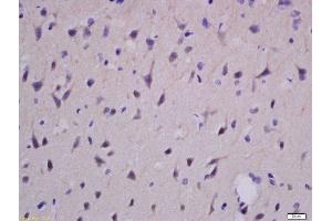 Immunohistochemistry (Paraffin-embedded Sections) (IHC (p)) image for anti-EPH Receptor A2 (EPHA2) (AA 901-976) antibody (ABIN669201)