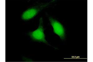 Immunofluorescence of purified MaxPab antibody to PSME2 on HeLa cell.