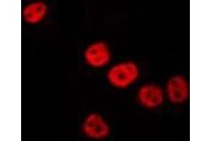 ABIN6275860 staining HepG2 by IF/ICC. (VRK3 Antikörper  (Internal Region))