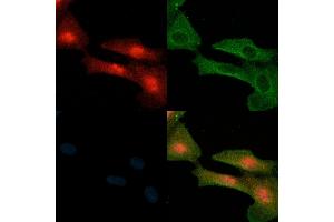ABIN6258843 and ABIN6274212 staining  cells(H2O2 treatment) by IF/ICC. (HMGB2 Antikörper  (Internal Region))