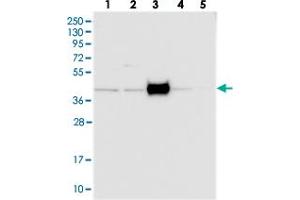 Western blot analysis of Lane 1: RT-4, Lane 2: U-251 MG, Lane 3: Human Plasma, Lane 4: Liver, Lane 5: Tonsil with FAM154B polyclonal antibody  at 1:250-1:500 dilution. (FAM154B Antikörper)