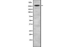 Western blot analysis of WBP7 using HuvEc whole cell lysates (Lysine (K)-Specific Methyltransferase 2B (KMT2B) (C-Term) Antikörper)