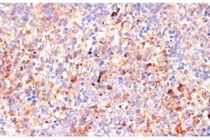 Immunohistochemistry of paraffin-embedded Mouse spleen using IL4R Polyclonal Antibody at dilution of 1:100 (40x lens). (IL4 Receptor Antikörper)