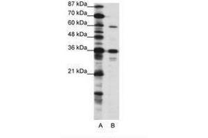 Image no. 1 for anti-CAMP Responsive Element Binding Protein 3-Like 1 (CREB3L1) (N-Term) antibody (ABIN202706) (CREB3L1 Antikörper  (N-Term))