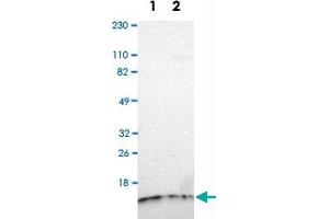 Western Blot analysis of Lane 1: RT-4 and Lane 2: U-251MG sp cell lysates with TIMM8A polyclonal antibody .