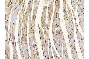 ABIN6262430 and ABIN6278873 at 1/100 staining mouse heart tissue by IHC-P. (IGFBP6 Antikörper  (Internal Region))