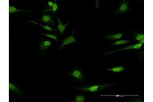 Immunofluorescence of purified MaxPab antibody to COQ3 on HeLa cell. (COQ3 Antikörper  (AA 1-369))