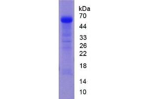 SDS-PAGE of Protein Standard from the Kit (Highly purified E. (Angiotensin I Converting Enzyme 1 CLIA Kit)