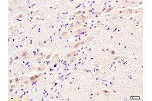 Formalin-fixed and rat brain tissue labeled with Anti-ADRA2 Polyclonal Antibody, Unconjugated  at 1:200 followed by conjugation to the secondary antibody and DAB staining