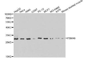 Western blot analysis of extracts of various cell lines, using PSMA6 antibody. (PSMA6 Antikörper  (AA 1-246))