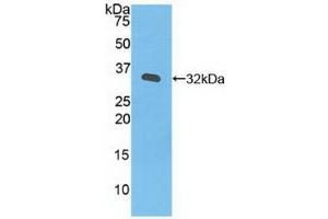 Detection of Recombinant JAK3, Human using Polyclonal Antibody to Janus Kinase 3 (JAK3) (JAK3 Antikörper  (AA 716-967))