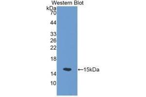 Detection of Recombinant SLC30A5, Mouse using Polyclonal Antibody to Solute Carrier Family 30, Member 5 (SLC30A5) (SLC30A5 Antikörper  (AA 639-751))