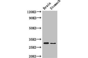 Western Blot Positive WB detected in: Mouse brain tissue, Mouse stomach tissue All lanes: COPS7B antibody at 3 μg/mL Secondary Goat polyclonal to rabbit IgG at 1/50000 dilution Predicted band size: 30, 19, 31 kDa Observed band size: 30 kDa (COPS7B Antikörper  (AA 1-157))