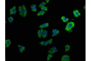Immunofluorescence staining of HepG2 cells with ABIN7139920 at 1:100, counter-stained with DAPI. (LPAR6 Antikörper  (AA 292-313))