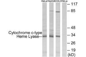 Western blot analysis of extracts from HeLa cells, HepG2 cells and COLO cells, using Cytochrome c-type Heme Lyase antibody. (HCCS Antikörper  (Internal Region))