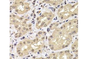 Immunohistochemistry of paraffin-embedded Human kidney using PSMD12 Polyclonal Antibody at dilution of 1:100 (40x lens). (PSMD12 Antikörper)