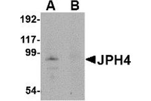 Western Blotting (WB) image for anti-Junctophilin 4 (JPH4) (Middle Region) antibody (ABIN1030971) (Junctophilin 4 Antikörper  (Middle Region))