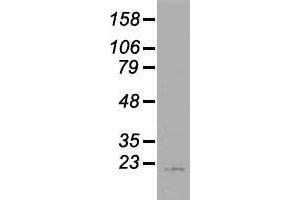 Western blot analysis of 35 µg of cell extracts from human (HeLa) cells using anti-AK1 antibody. (Adenylate Kinase 1 Antikörper)