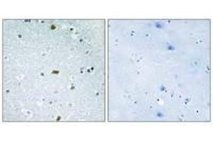 Immunohistochemistry analysis of paraffin-embedded human brain tissue, using ZFHX3 antibody. (ZFHX3 Antikörper)