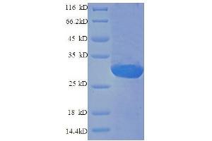 SDS-PAGE (SDS) image for Endothelin 1 (EDN1) (AA 53-73) (Active) protein (GST tag) (ABIN1046972)