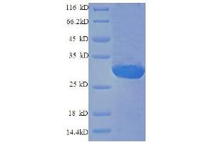 Endothelin 1 (EDN1) (AA 53-73), (full length) protein (GST tag) (Endothelin 1 Protein (EDN1) (AA 53-73) (GST tag))