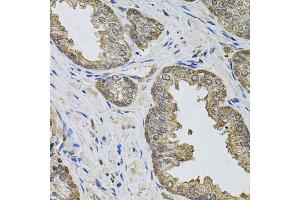 Immunohistochemistry of paraffin-embedded human prostate using IGSF3 antibody (ABIN5975786) (40x lens). (IGSF3 Antikörper)