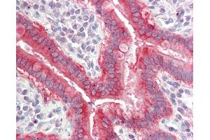 Anti-SLC7A8 / LAT2 antibody IHC staining of human small intestine.