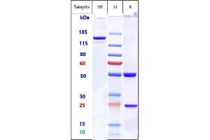 Anti-ADAM9 Reference Antibody (Imgc936) on SDS-PAGE under reducing (R) condition.