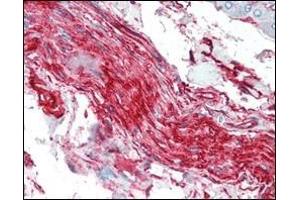 Immunohistochemical analysis of paraffin-embedded human nerve and ganglion cells using S100A10/P11 antibody. (S100A10 Antikörper)