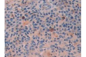Immunohistochemistry (IHC) image for anti-Activating Transcription Factor 4 (Tax-Responsive Enhancer Element B67) (ATF4) (AA 130-347) antibody (ABIN7433582)