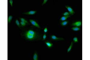Immunofluorescence staining of Hela cells with ABIN7155077 at 1:133, counter-stained with DAPI. (HPS6 Antikörper  (AA 221-319))